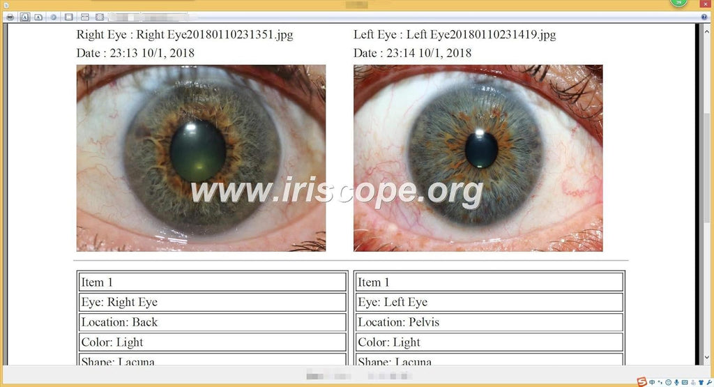 USB Iridology Camera with Software Y911525
