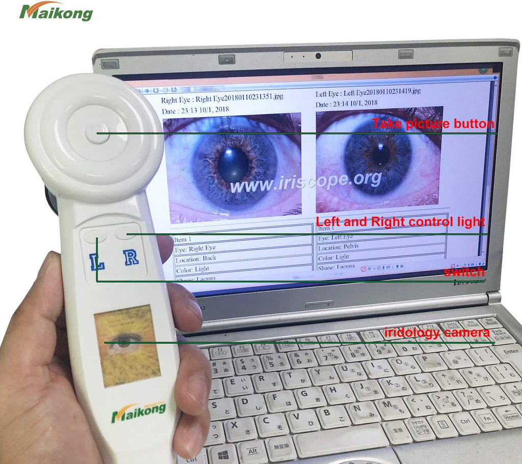 USB Iridology Camera with Software Y911525