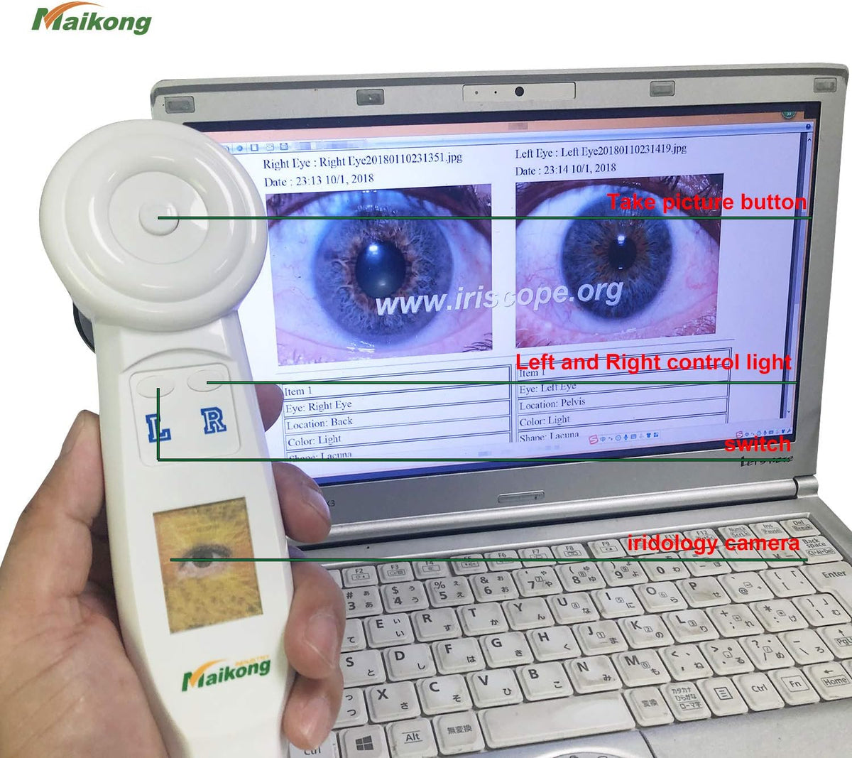 USB Iridology Camera with Software Y911525