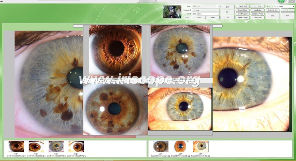 USB Iridology Camera with Software Y911525